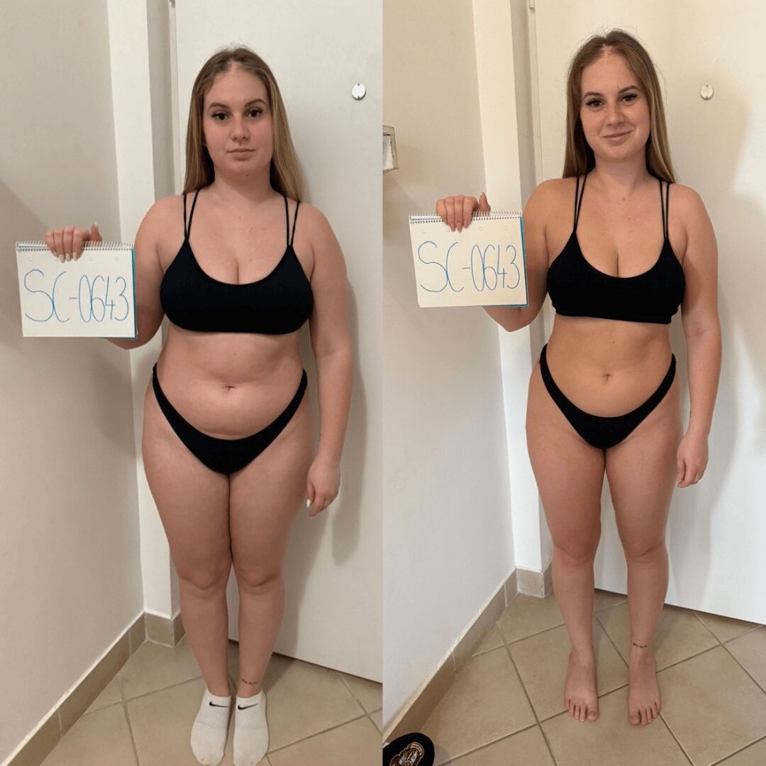 22